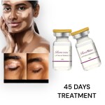 AdiExpress Effectively Remove Vitiligo Ointment Remove Ringworm White Spot Removal VANISH CREAM