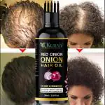 KURAIY Red Onion black seed hair oil spray, natural hair care and hair growth, prevent hair loss, biotin fast hair growth (50 ml ) & (MEN & WOMEN)