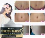 KURAIY Natural Skin Smooth Repair Cream Remove Stretch Marks Treatment Maternity Repair Anti-Aging Anti-Wrinkles Firming Stretch Mark