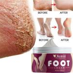 KURAIY Active Chapped Hand and Foot Cream Crack Peeling Repair Anti Dry Skin Remove Dead Skin Foot Moisturizing (50gm) (For Women and men) Pack of 1