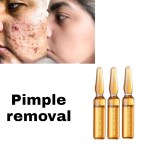 AdiExpress, skin whitening cream skin lite cream skin care cream, skin protector ayurvedic cream peeling cream for skin care glowing skin product