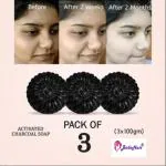 BADA HAIR _ Activated Charcoal Soap for skin whitening, Treat Oily Skin