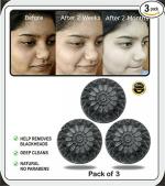Hairhorn Handmade Chemical Free Charcoal Soap For Women Skin Whitening, Natural Detox Face & Body Soap for Acne, Blackheads, Anti Wrinkle, Pimple Skin Care Charcoal Soap.|100 g. pack of 3