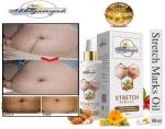 Abhigamyah Stretch Mark Removal & Dark Spots Reduction Skin Therapy Oil + Free Body Firming.