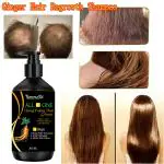 SOMWRITA Ginger Black Hair Growth & Healthy Hair Shampoo | Ginger Anti-Dandruff Shampoo For Healthy Scalp & Hair | Damage Repairs | Ginger Shampoo for Men & Women - pack of 1 [300ml].