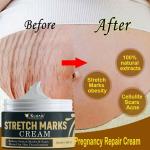 KURAIY Natural Maternity Scar Cream Pregnancy Stretch Marks Remove Cream 7 Day Effect Essential Oil Skin Care Repair Anti-White Stretch 50g