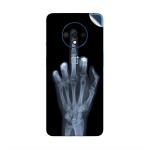 GADGETSWRAP Printed Vinyl Skin Sticker for Oneplus 8 - X Ray Hand