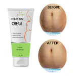 EIBHC Stretch Marks Cream Dermatologist Approved Reduce and Prevent Stretch Marks Reduces Scars Spots 100G