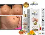 Abhigamyah Stretch Marks Oil With Lavender Oil -Reduce Stretch Marks and Moisturizes Skin