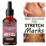 Groovy after delivery stretch mark removal OIL100% organic 40ml