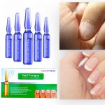 AdiExpress repair nail fungus, nail repair growth serum, nail care serum, nail cream, nail repair treatment