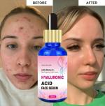 AMR Beauty | Hyaluronic Face Serum | 30ml |__07