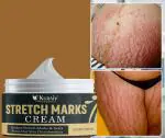 KURAIY 100% Pure Stretch Mark Vanishing Cream Repair Anti-Wrinkle Anti-Aging Pregnant Women Stretch Marks Treatment Cream Vitamin E Skin Care 50g