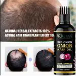 KURAIY Fast Hair Growth Red ONION OIL Essence OIL Essential Oils for Thicker Healthier for Men and Women 50ML