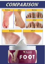 KURAIY Safe Foot Care Cream for Rough, Dry and Cracked Heel