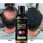 KURAIY Care Hair Growth Essential Oils Anti Hair Loss Health Care Fast Hair Growth Hair Growth Beauty Dense Red Onion Oil for Hair Growth (50 ml) & (MEN & WOMEN)