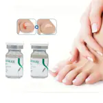 AdiExpress Toe nails cuticle remover Onychomycosis Essence Liquid Anti Infection