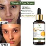 . Say Goodbye to Uneven Skin Tone with Vitracos Vitamin C Face Serum