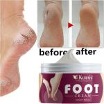 KURAIY New Chapped Hand And Foot Cream Crack Peeling Repair Anti Dry Skin Remove Dead Skin Foot Moisturizing (50gm) (For Women and men) Pack of 1