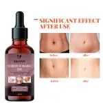 Groovy Stretch Mark Removal Oil For Men And Women 40 ml)
