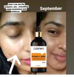 CONWY De-Pigmentation Skin Care - C For Yourself Vitamin C Serum (32 ML)
