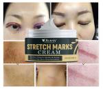 KURAIY New Effective Remove Pregnancy Scars Acne Cream Stretch Mark Treatment Maternity Repair Anti-Aging Anti-Winkle Firming Body Cream