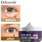KURAIY Eye Cream for Dark Circle | Dark Circle Remover Cream | Wrinkles Removal Cream For Women and Men.
