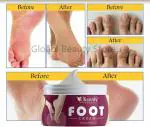 KURAIY 100% FEET NEED TO SPECIAL CARE FOR CRACK CREAM