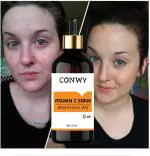 CONWY De-Pigmentation Skin Care - C For Yourself Vitamin C Serum (32 ML)