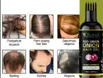 KURAIY Onion Black Seed Hair Oil| Amla Hair Oil| Coconut Hair Oil| Almond Hair Oil| Alovera Extracts Hair Oil| Bhringraj Hair Oil| ( 50 ml) & (MEN & WOMEN)