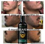 KURAIY Beard Growth Oil 100% Natural Beard Growth Essence Hair Loss Products Beard Care Hair Growth Nourishing Enhancer Beard Care