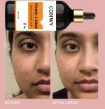 CONWY Dark Circle Damage Corrector Face Serum (32 ML)