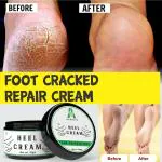 ALOETIC Foot Cream For Rough, Dry and Cracked Heel | Feet Cream For Heel Repair |Healing & softening cream| aloevera foot cream | foot crack cream | foot crack for tired heel|heel crack cream |- (50 gm.)