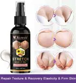 Kuraiy New Repair Stretch Marks Removal Natural Heal Pregnancy Breast, Hip,Legs