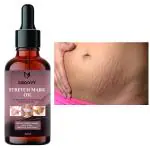 Groovy present Repair Stretch Marks Removal - Natural Heal Pregnancy Breast, Hip, Legs, Mark oil 40 ml pack of 1