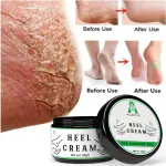 ALOETIC Foot Cream For Rough, Dry and Cracked Heel | Feet Cream For Heel Repair |Healing & softening cream| aloevera foot cream | foot crack cream | foot crack for tired heel|heel crack cream |- (50 gm.)