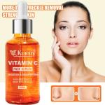 Kuraiy Natural Vitamin C Brightening Skin Face Serum | Fades Dark Spots & Hyper Pigmentation | Experience Glowing Skin | Dermatologically Tested | For Men & Women | All Skin (30 ml)