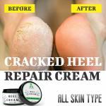 ALOETIC Foot Cream For Rough, Dry and Cracked Heel | Feet Cream For Heel Repair |Healing & softening cream| aloevera foot cream | foot crack cream | foot crack for tired heel|heel crack cream |- (50 gm.)