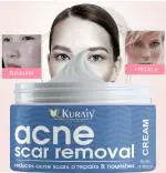 KURAIY 100% Herbal Acne Treatment Cream Pimples Scar Removal Facial Cream Oil Control Shrink Pores Skin Care