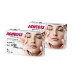 Acnedis Herbal Soap Bar - 150 g (Pack of 2)