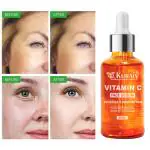 Kuraiy Best Vitamin C Brightening Skin Face Serum | Fades Dark Spots & Hyper Pigmentation | Experience Glowing Skin | Dermatologically Tested | For Men & Women | All Skin (30 ml)
