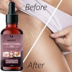 Groovy Organic Body stretch mark removal Oil | Anti Aging | Pregnancy Stretch Mark Removal Oil| Scar Removal | Anti Wrinkle | Skin Hydration 40 ml