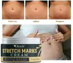 KURAIY Pure new Scar Removal Cream 50g Scar Removal Cream Scar Repair & Remover Cream Scar Cream For Acnes Marks Scars Scratches Burns