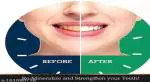 Sthetik Teeth Whitening Foam Toothpaste Makes You Reveal Perfect & White Teeth Teeth Whitening Kit