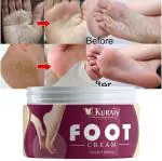 KURAIY Best Chapped Hand and Foot Cream Crack Peeling Repair Anti Dry Skin Remove Dead Skin Foot Moisturizing (50gm) (For Women and men) Pack of 1