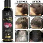 GLOW OCEAN - GLOW EVERYDAY Onion Black Seed oil For Hair Fall Control, Hair Growth & Hair Regrowth Hair Oil (100 ml)