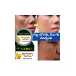 Evedics Herbal & Cosmetics Hyperpigmentation, Nalla Machalu, Mangu Machalu, Dark Face, Dark Spots on face, dark circle removal cream, Skin Brightening & Whitening & Glowing Real for Men & Women Daily Use Pack of 1