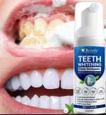 KURAIY Teeth Foam Effectively Remove Yellow Plaque Smoke Stain Dental Cleaning Fresh Breath 60ml
