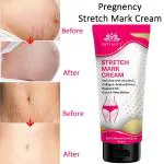 Intimify Natural & Effective Stretch Mark Cream for Skin, Stretch Mark (50 gms)