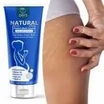 7 Days Stretch Marks Scar removal Cream during after pregnancy remove Hyperpigmentation (100 g)